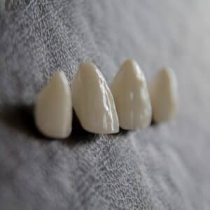 Photo Tooth Implant Price
