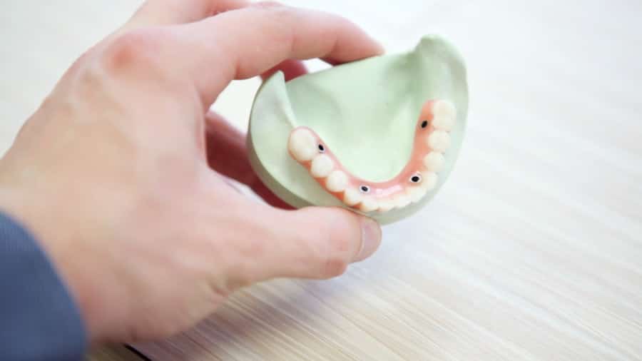 Photo Dental Implants