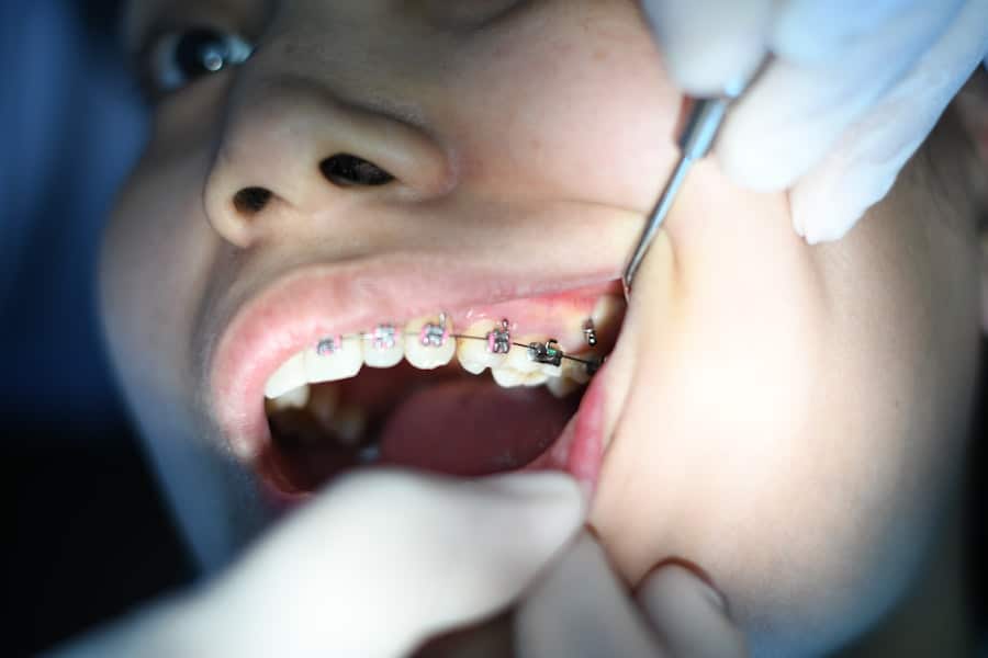 Photo Replacing Missing Teeth