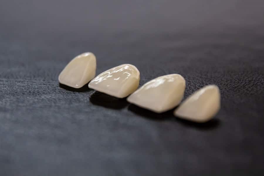 Photo Dental Implants