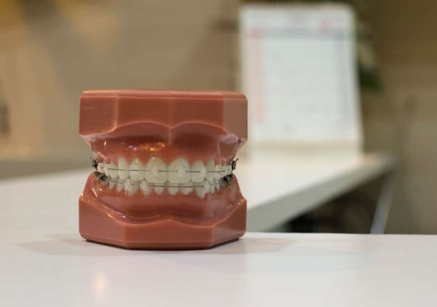 Photo Dental Implant Financing