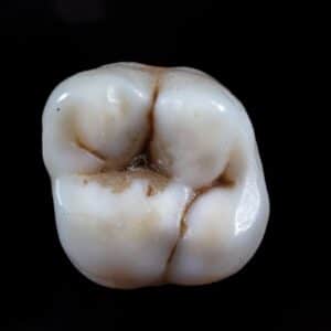 Photo Dental Implant Surgery
