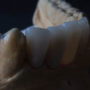 Photo Implant Dentist