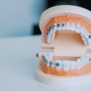 Photo Dental Implants