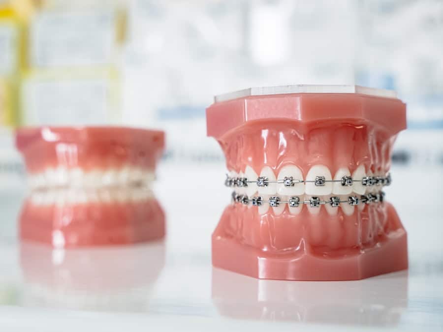 Photo Dental Implants